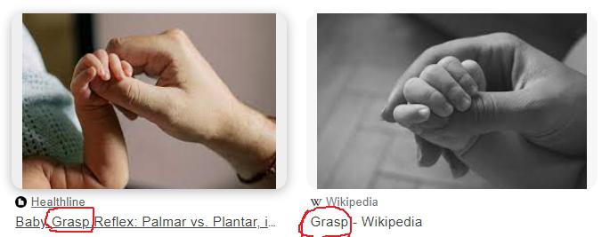 Palmar grasp reflex - Wikipedia